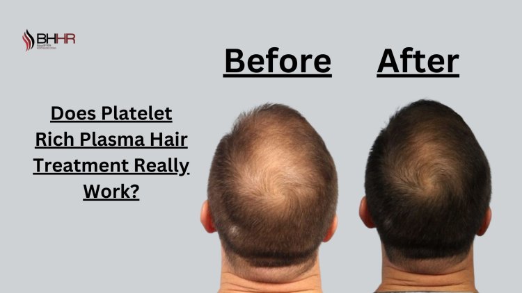 Does Platelet Rich Plasma Hair Treatment Really Work?